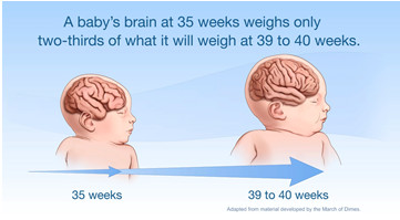 051013-baby-brain